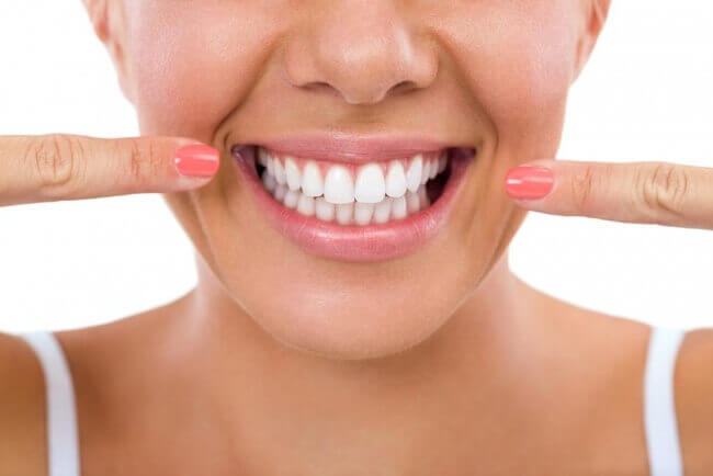 dental-veneers-porcelain-veneers