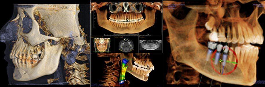 x-rays