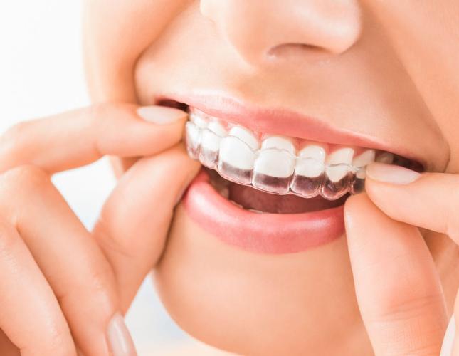Read this if you're considering online clear aligners or other online dental products!