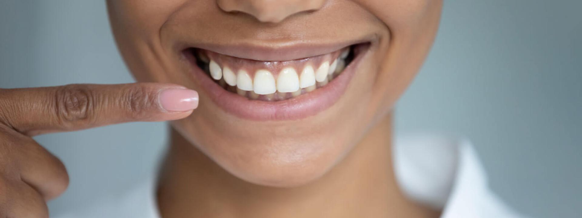 Healthy gums